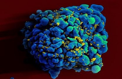 利用新冠疫苗平台技术，实验性mRNA艾滋病