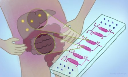 双器官芯片模拟脂肪肝产生机制
