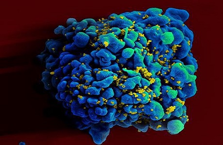 利用新冠疫苗平台技术，实验性mRNA艾滋病疫苗前景看好