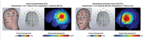 脑电刺激能提高记忆力，效果可维持至少